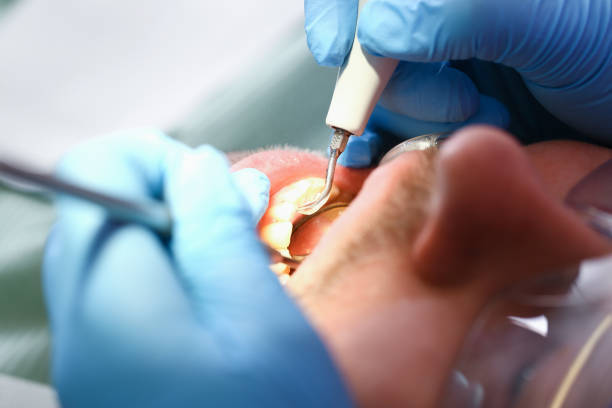 Best Emergency Root Canal Treatment in Maypearl, TX