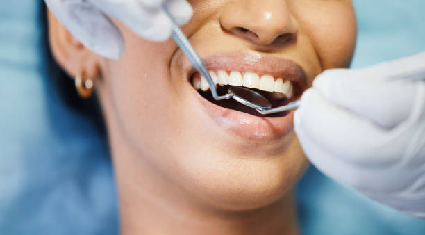 Best Orthodontic Emergency Dentist in Maypearl, TX