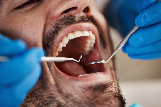 Best Mobile Emergency Dentist in Maypearl, TX
