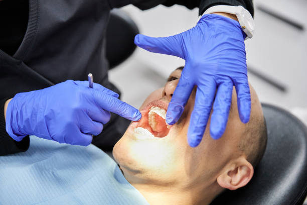 Best Emergency Dentist for Lost Fillings or Crowns in Maypearl, TX